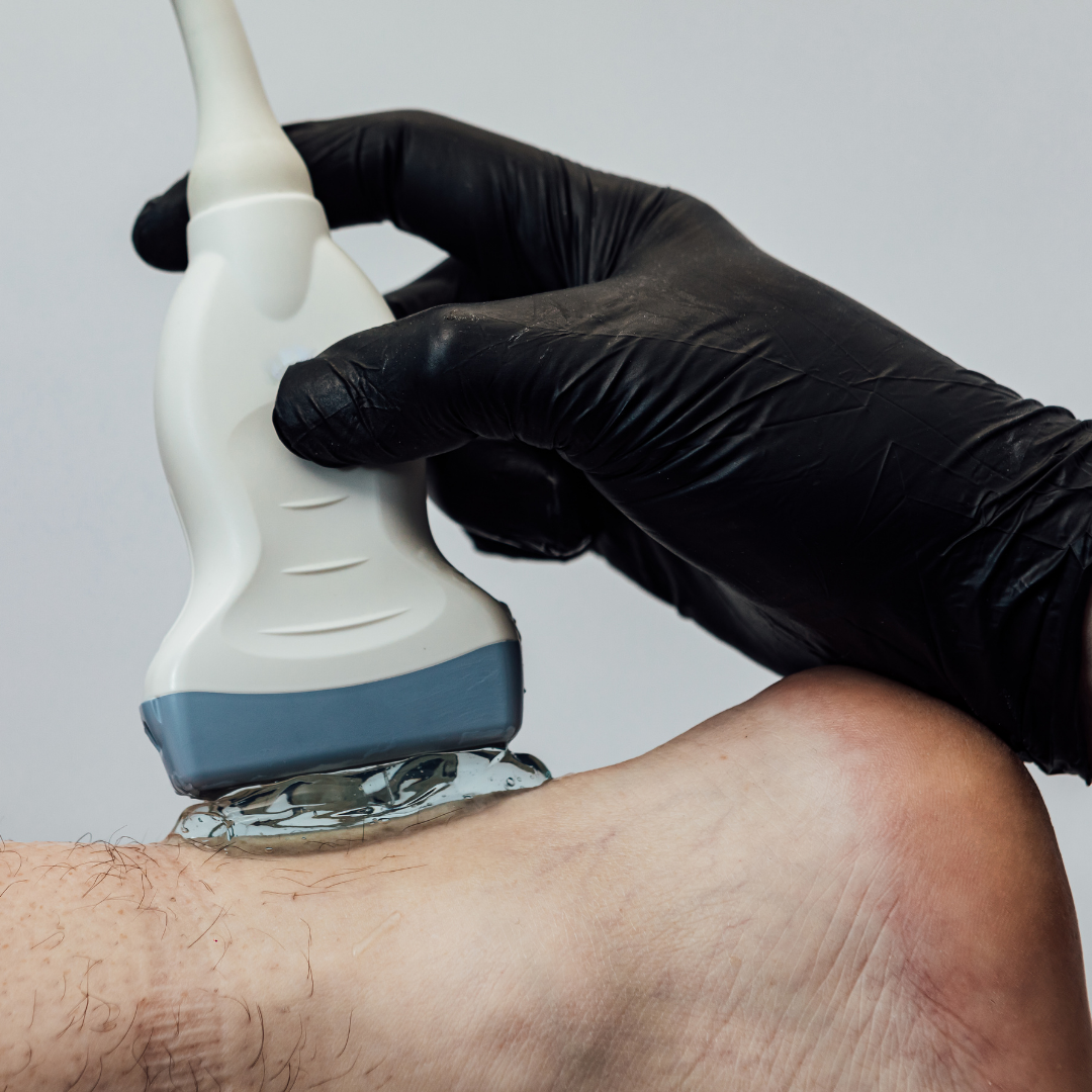 Sonografía Musculoesquelética